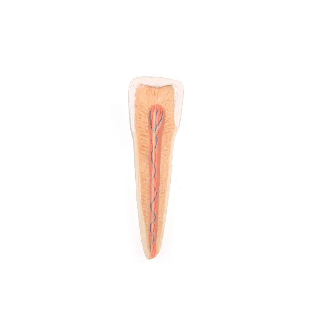 Advanced Half Lower Jaw with 8 Diseased Teeth