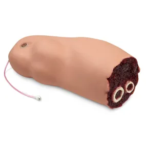 Amputed Leg for SMART STAT