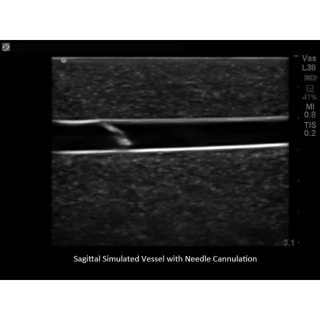 Branched 2 Vessel Ultrasound Training Block