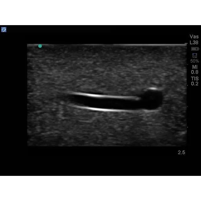 Branched 2 Vessel Ultrasound Training Block
