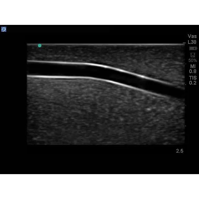 Branched 2 Vessel Ultrasound Training Block