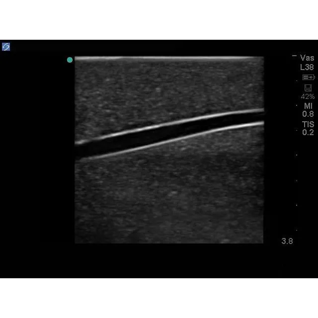Branched 2 Vessel Ultrasound Training Block