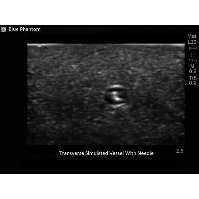 Branched 2 Vessel Ultrasound Training Block