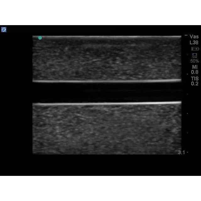 Branched 2 Vessel Ultrasound Training Block