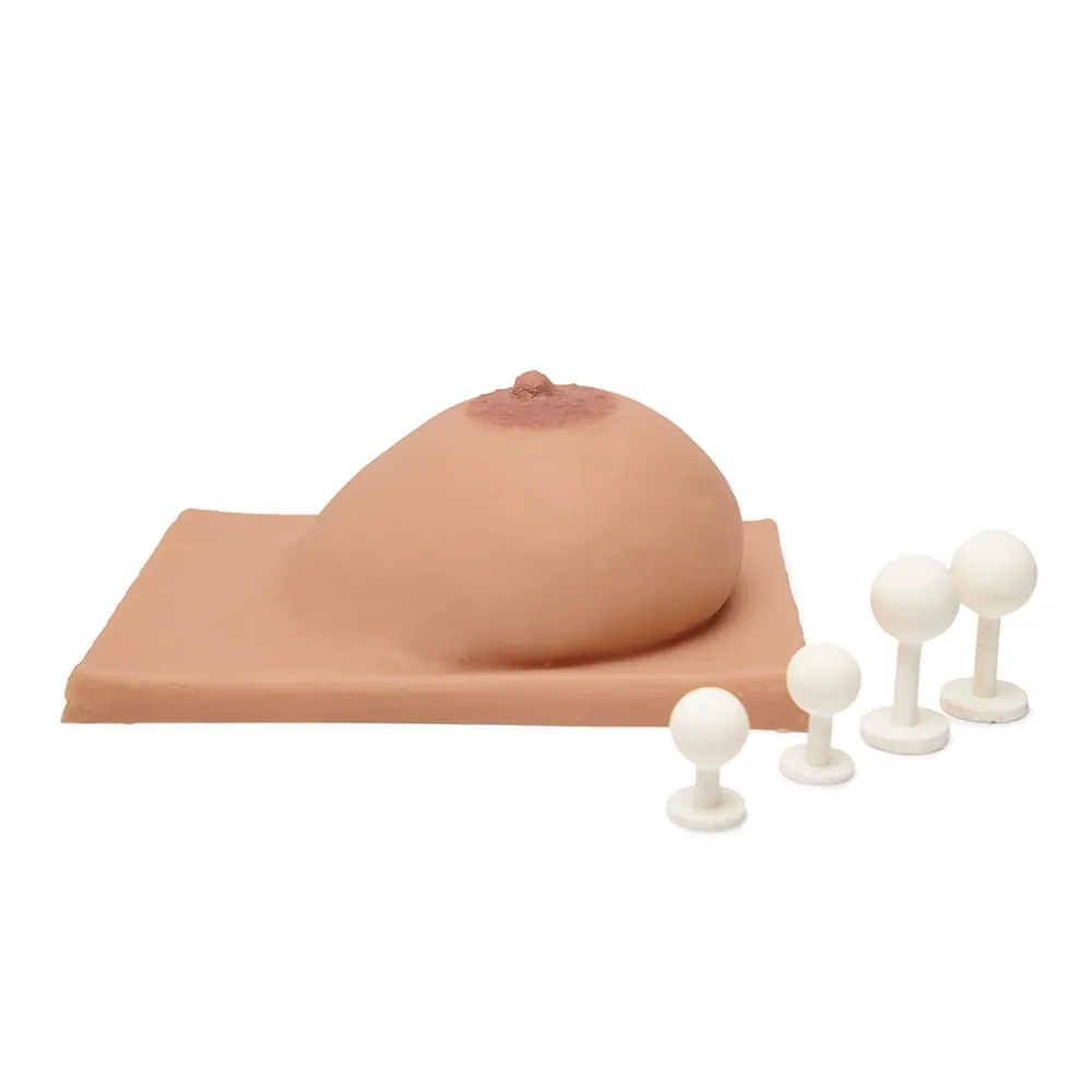Breast Without Lactation With Mass