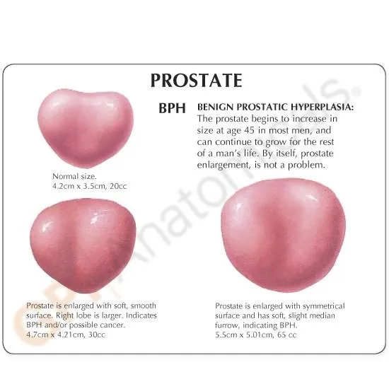 Male Pelvis with Prostate Model