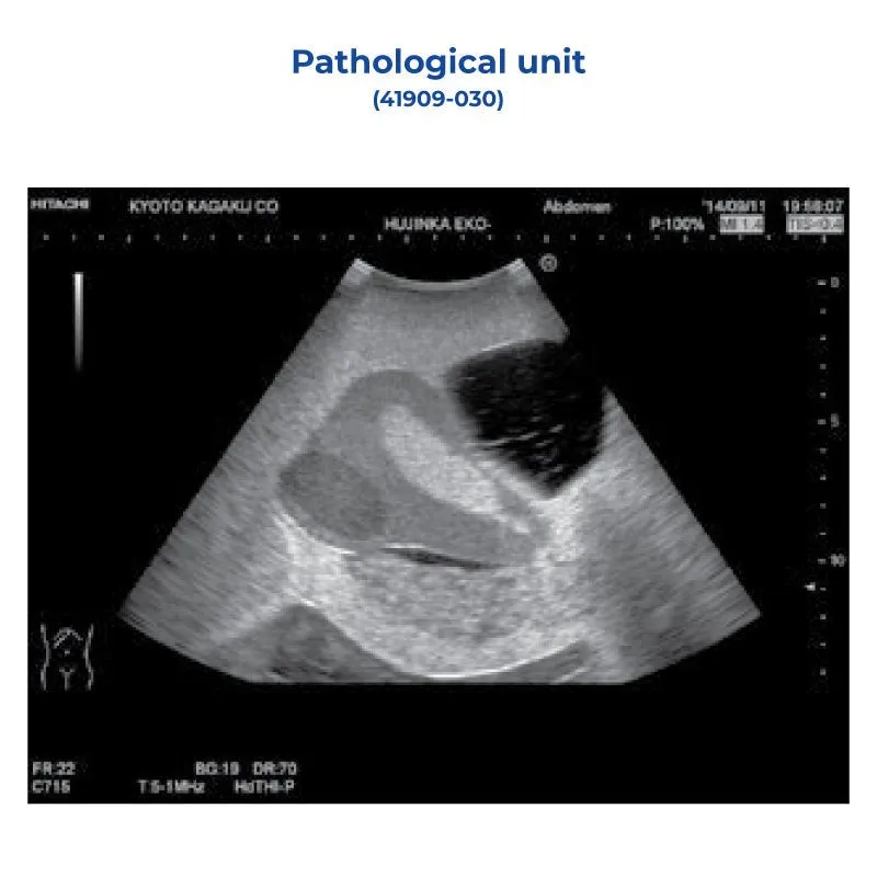 Pathology Unit