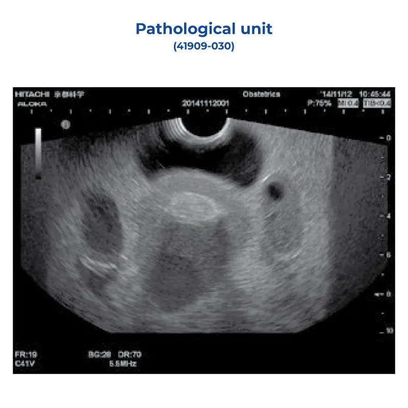 Pathology Unit