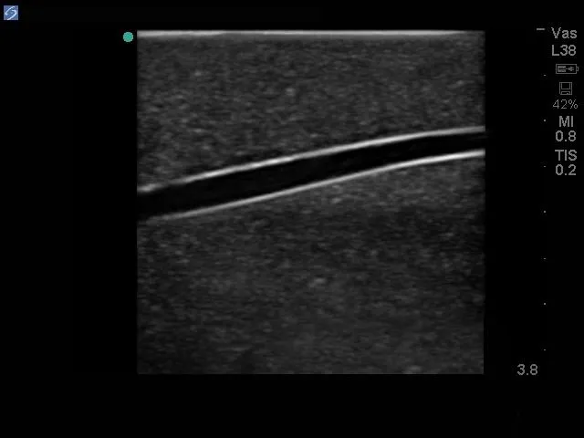 Pediatric 4 Vessel Ultrasound Training Block