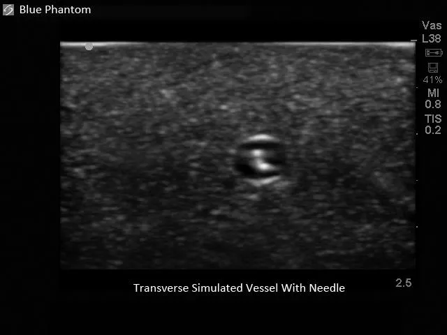 Pediatric 4 Vessel Ultrasound Training Block