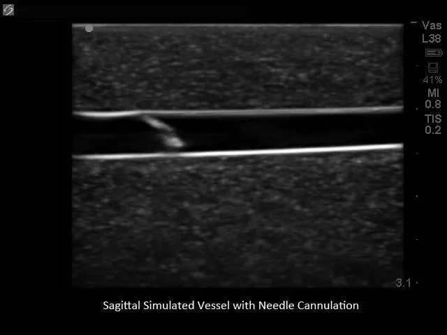 Pediatric 4 Vessel Ultrasound Training Block