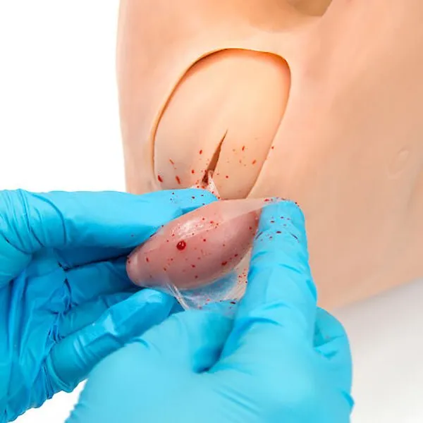 Replacement Castration Module for 'Weany'