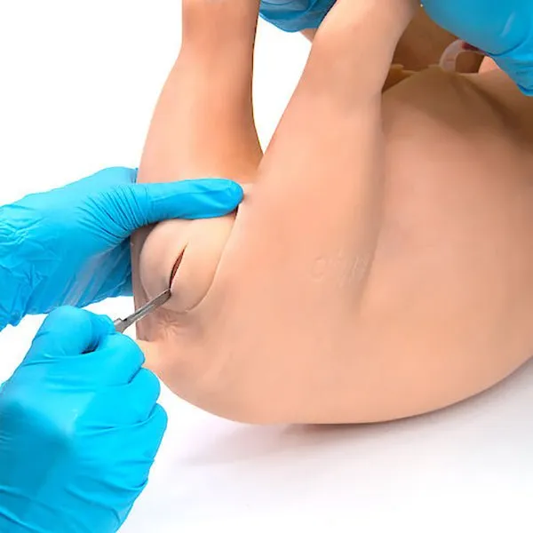 Replacement Castration Module for 'Weany'