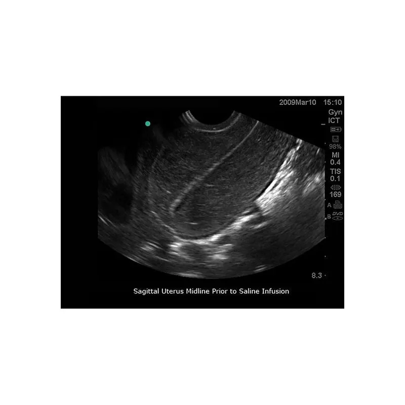 Sonohysterographay & Sonosalpingography Transvaginal Ultrasound Training Model