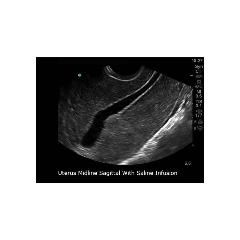 Sonohysterographay & Sonosalpingography Transvaginal Ultrasound Training Model