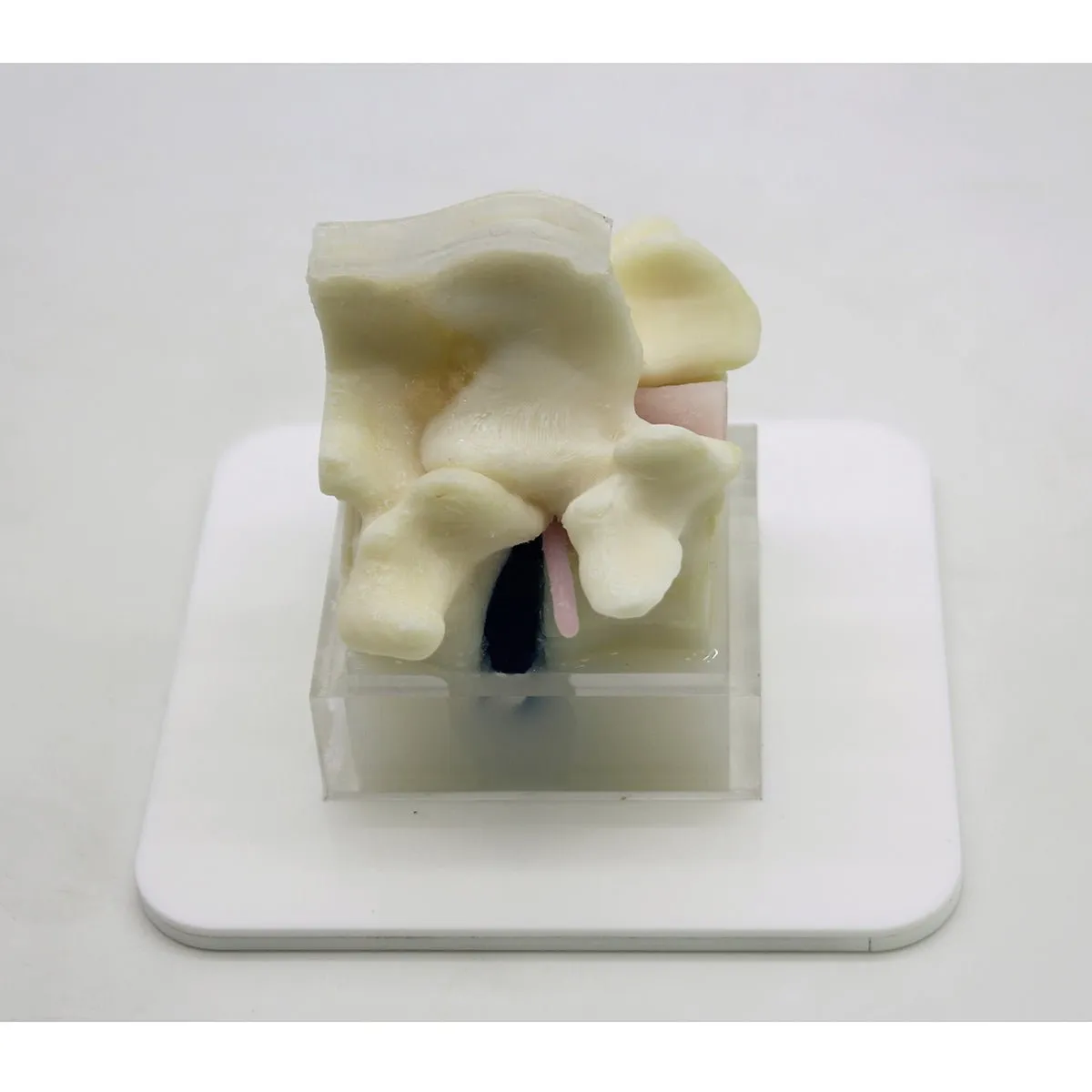 Spine Surgery Simulator For Surgical Training, Basic