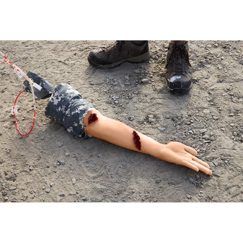 Stop the Bleed Arm with Belt