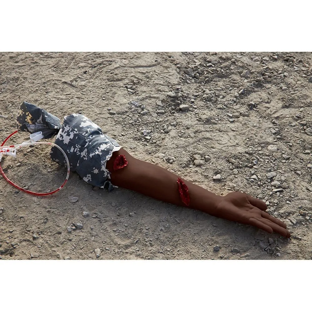 Stop the Bleed Arm with Belt