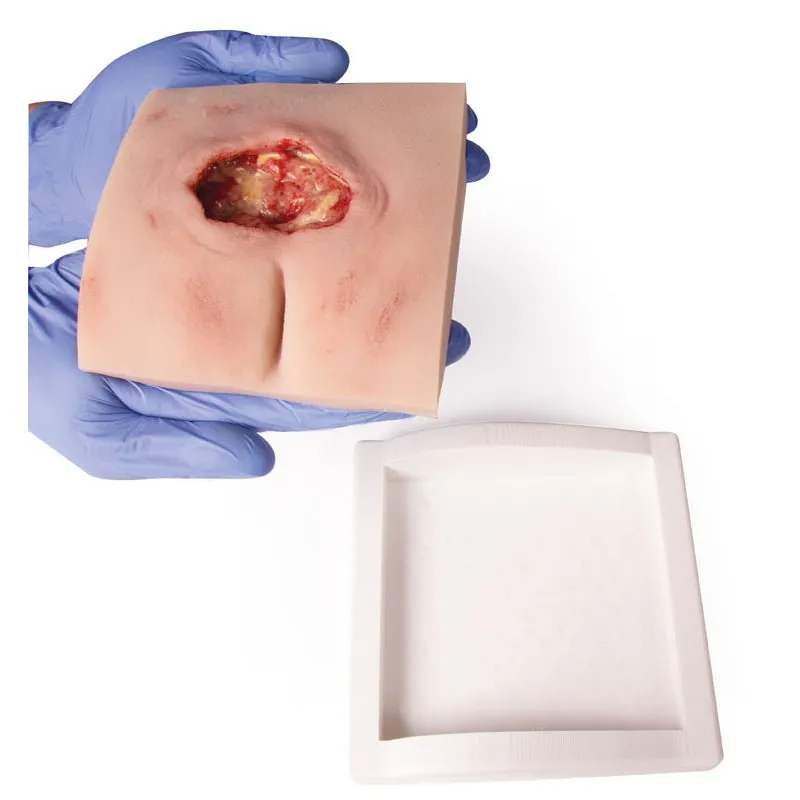 Wound Moulage Sacral Decubitus, Cleaned Including Stand