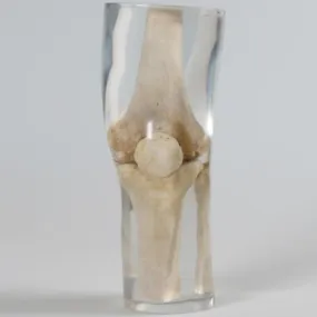 X-Ray Phantom Knee, Transparent